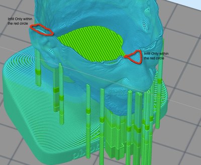 Selective infill - example