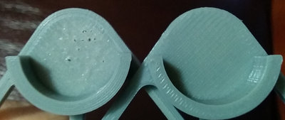 Comparison 1
